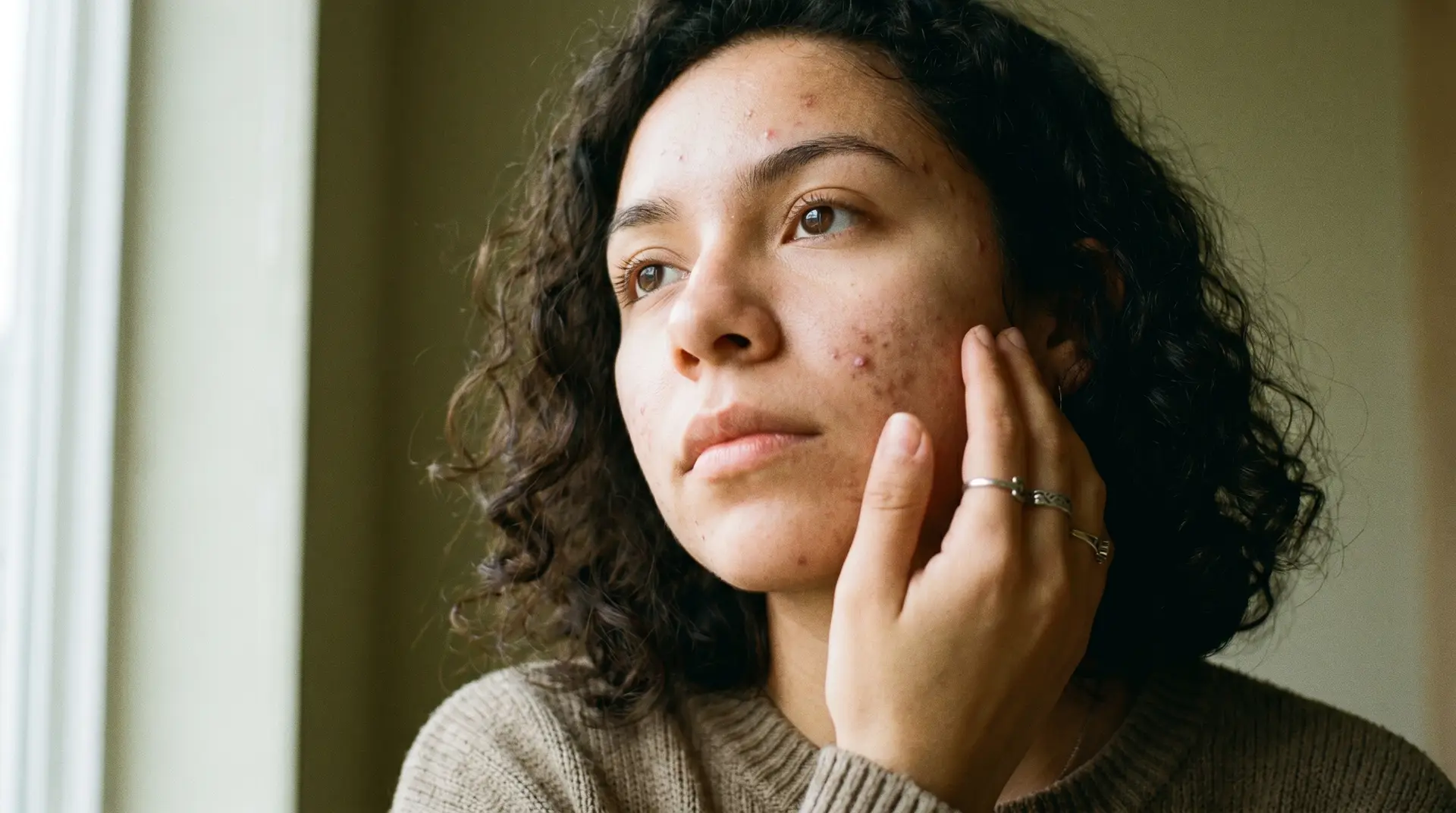 Young Hispanic woman with mild acne touching her cheek thoughtfully in soft natural light