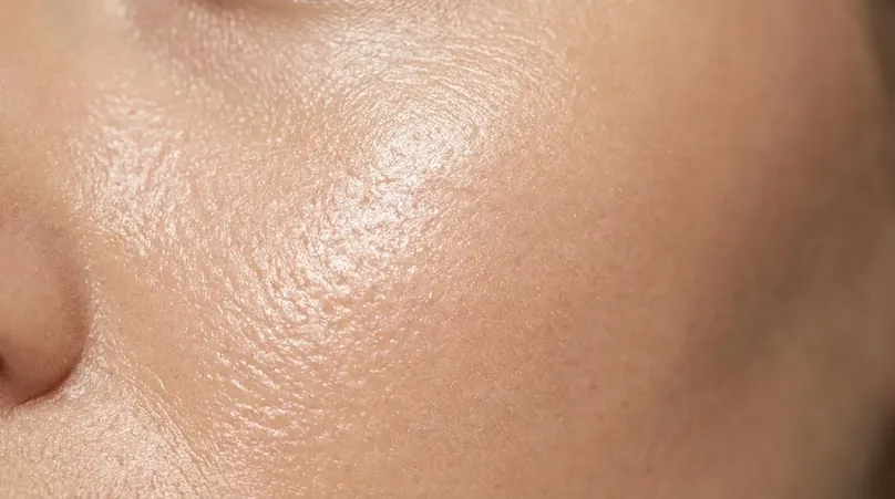 Microneedling 101: Benefits, Recovery, and Real Results